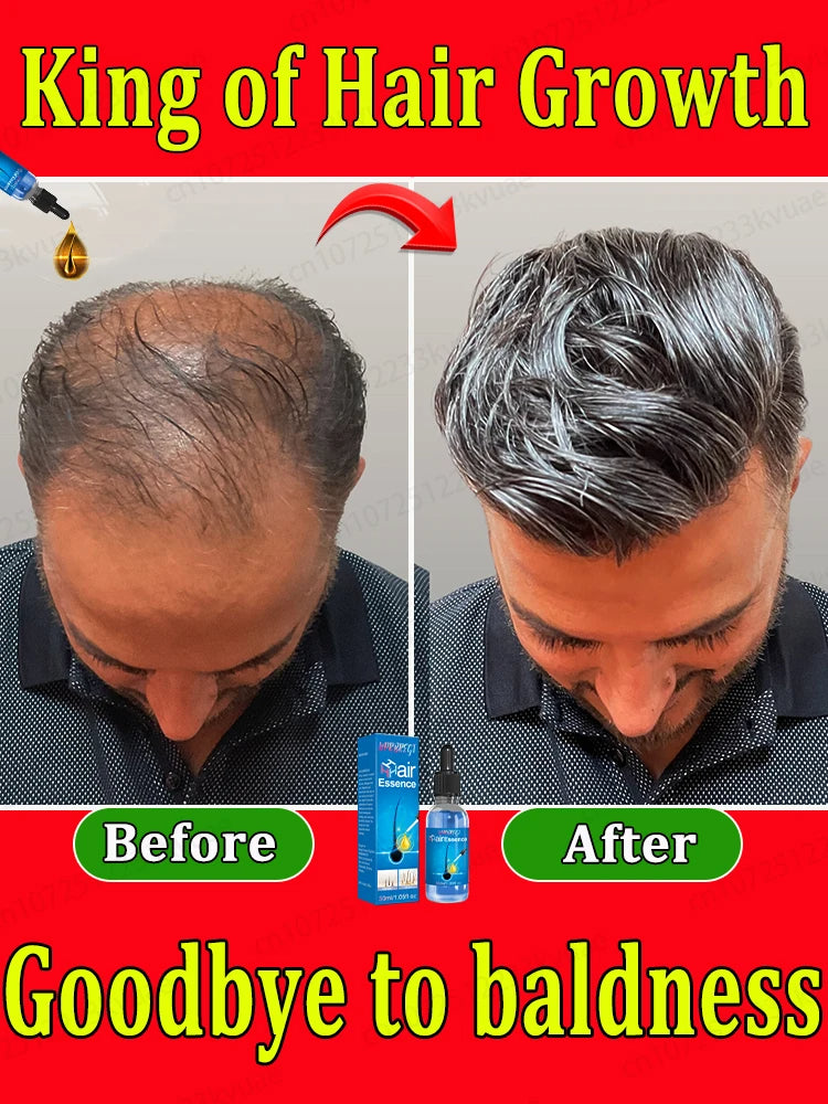 The most effective hair growth essential oil in 2024 Experts Authoritatively certified Effective in repairing baldness and hair