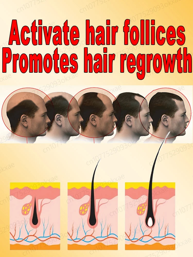 The most effective hair growth essential oil in 2024 Experts Authoritatively certified Effective in repairing baldness and hair