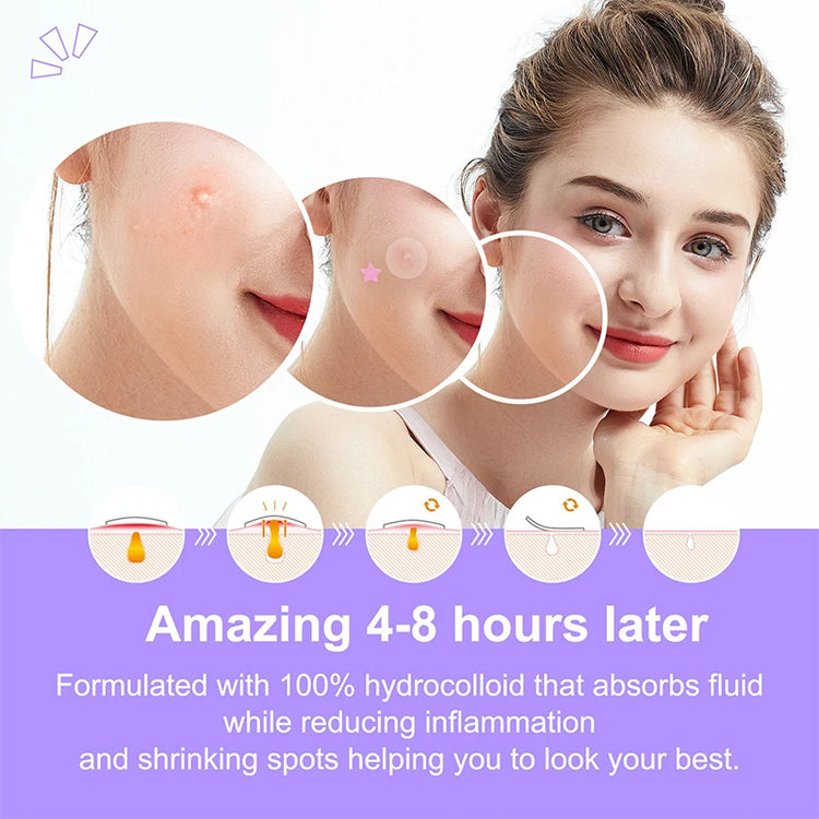 Star Pimple Patch Acne Colorful Invisible Acne Removal Skin Care Stickers Originality Concealer Face Spot Beauty Makeup Tool