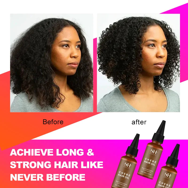 Hair Growth Products for Women Africa Traction Alopecia Chebe Hair Growing Oil Anti Hair Loss Treatment Thicken Hair Care