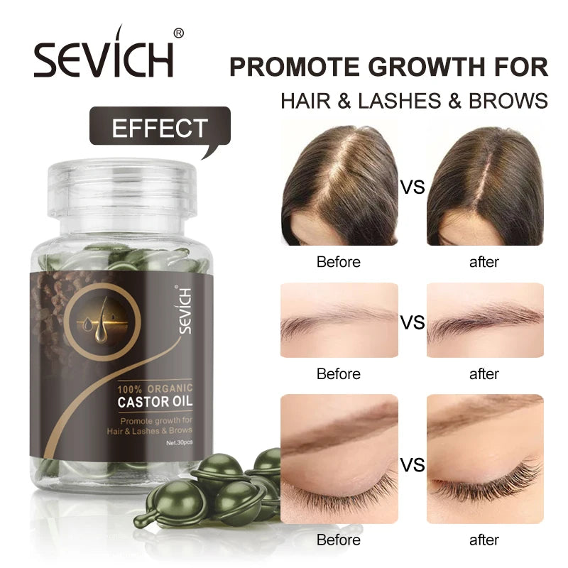 30Pcs/bottle Ginger Anti-Hair Loss Capsules Hair Growth Conditioning Oil Vitamin Repair Dry Hair Scalp Care Products