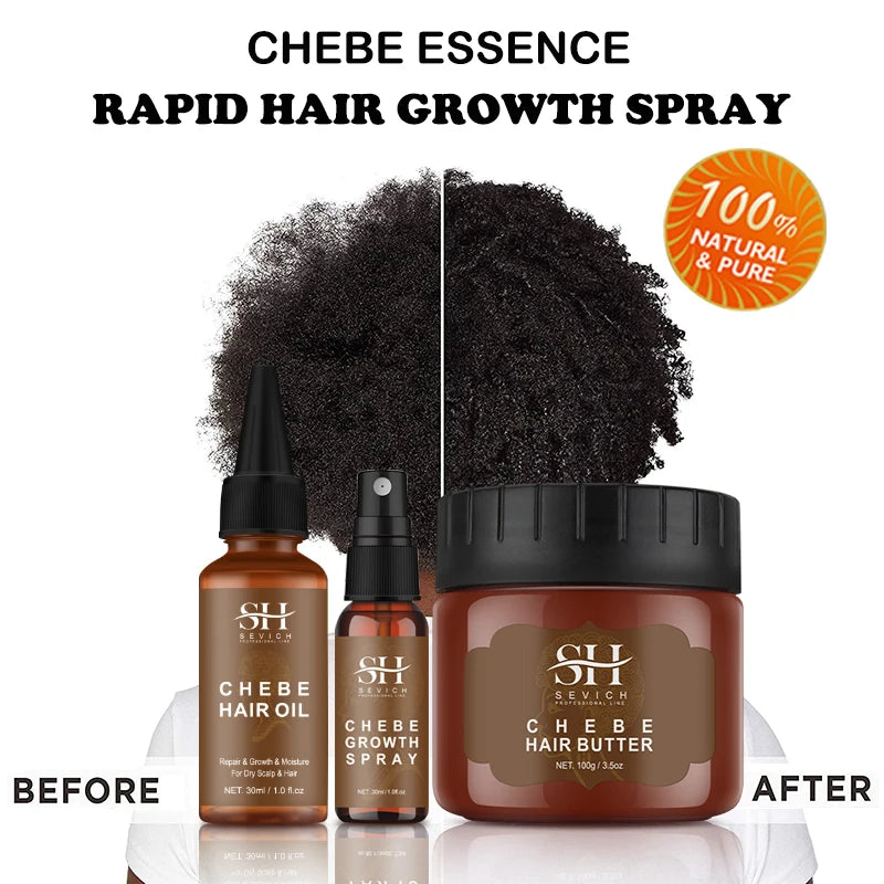 Chebe Traction Alopecia Thicken Oil Anti Hair Loss Treatment Spray Craze Fast Hair Growth  Products Sevich Anti Break Hair Care